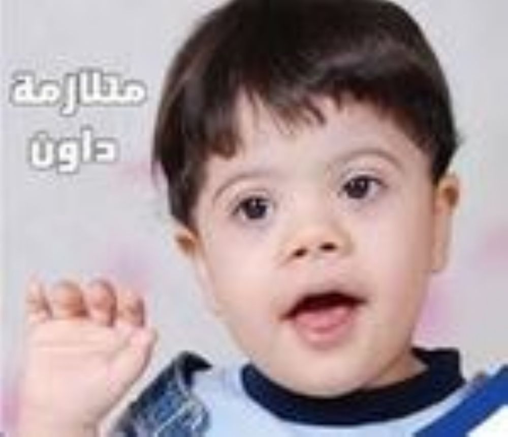 متلازمة داون تطور الطفل ومراحل العلاج البديل بالاعشاب جديد الطب العربي البديل