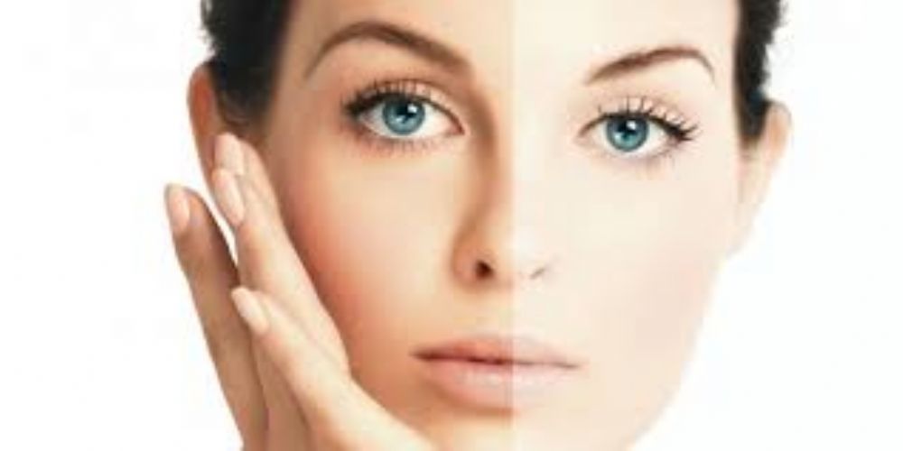 اربعة وصفات طبيعية لتبييض بشرة الوجه ( رائع) من تقنيات الطب البديل